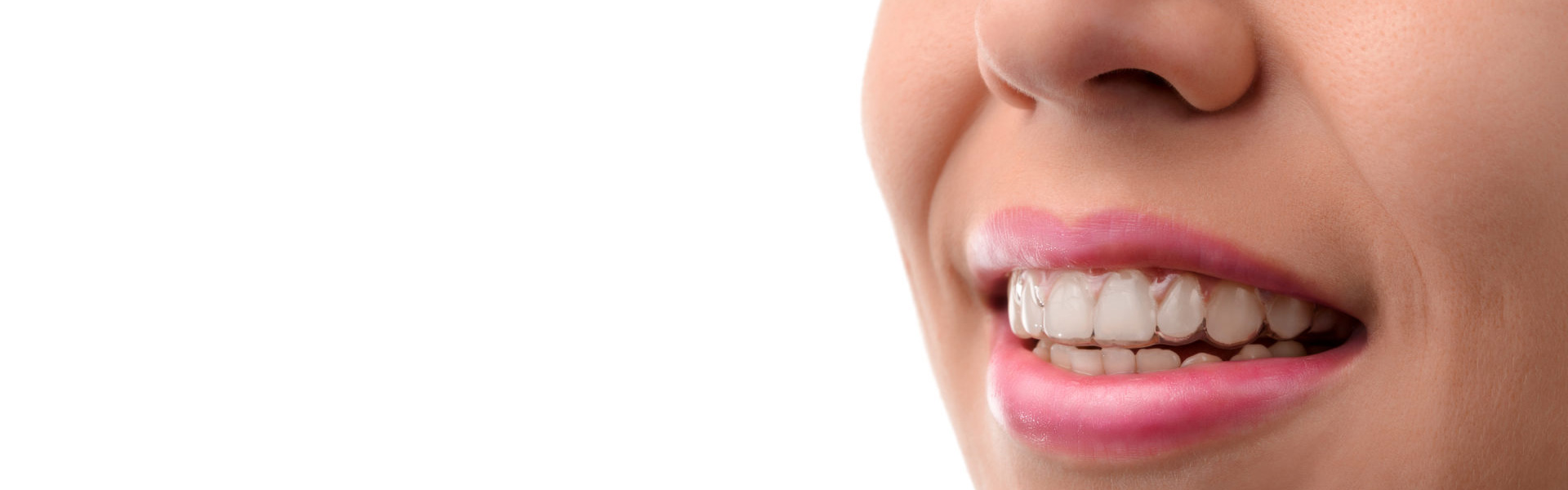 Expert tips to improve your Invisalign Clear Braces experience.